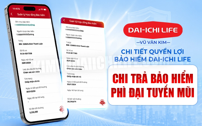 Quyền Lợi Bảo Hiểm Dai-Ichi Life Chi Trả Bảo Hiểm Phì Đại Tuyến Mũi
